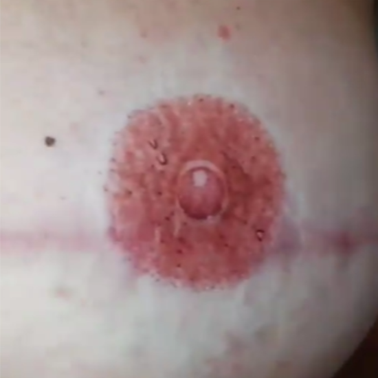 Permanent Make Up Professionals - Areola - Lena - PMU Pros