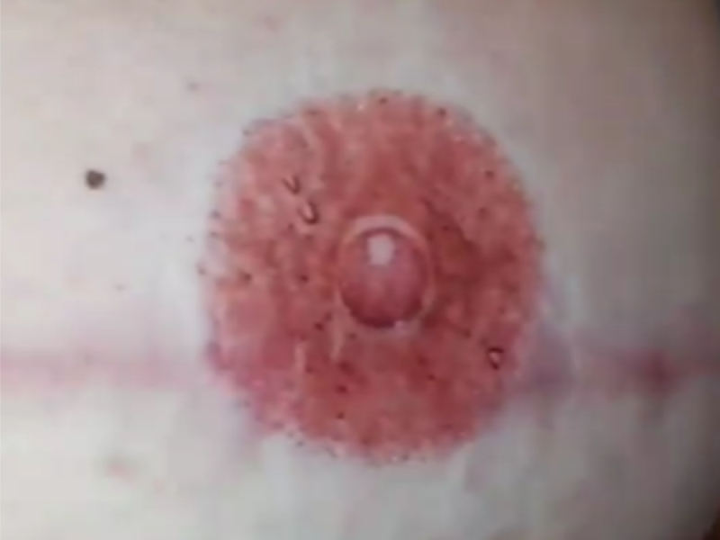 Permanent Make Up Professionals - Areola - Lena - PMU Pros