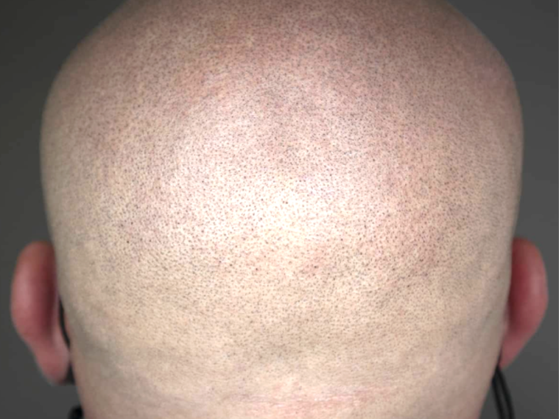 Permanent Makeup Professional Workshop - Piotr treatment - SMP