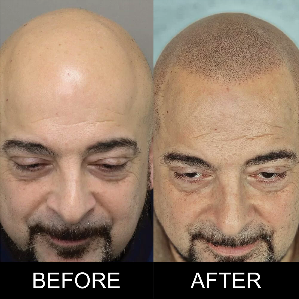 Permanent Makeup Professional Workshop - Piotr treatment - SMP